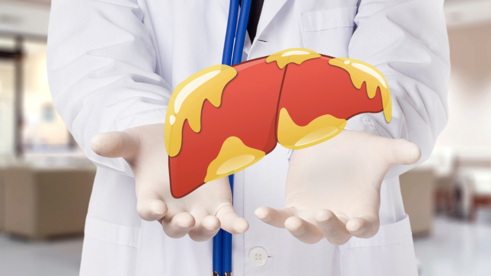 fatty liver complications