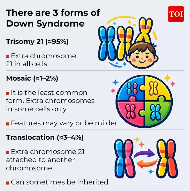 The 3 forms of Down Syndrome Down 2